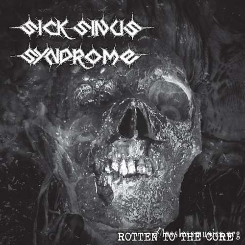 Sick Sinus Syndrome - Rotten To The Core (2021)